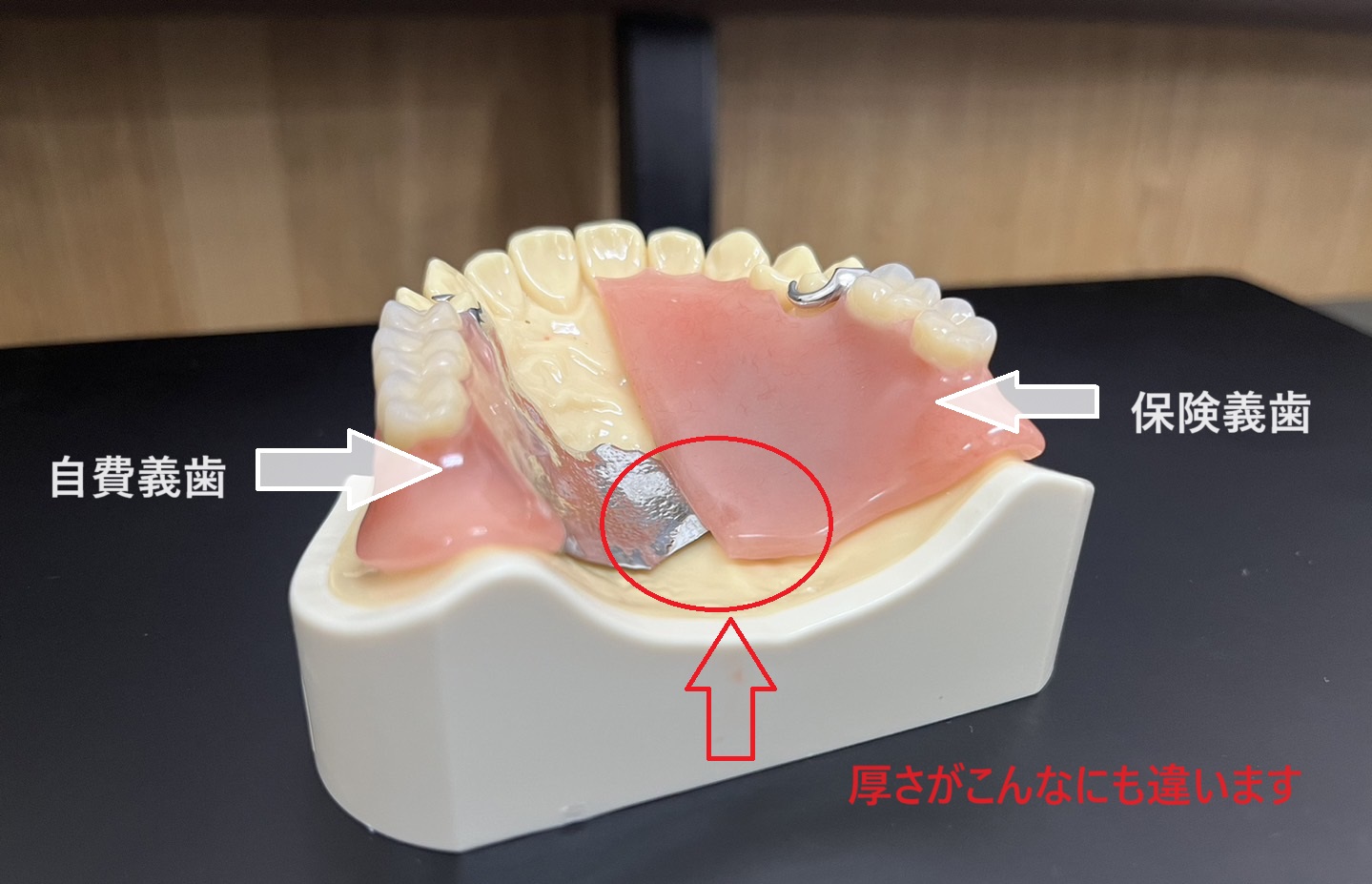 保険義歯と自費義歯の違い